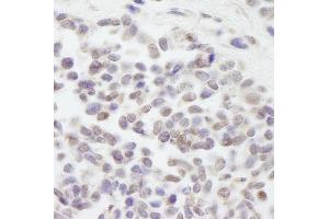 anti-Cullin 3 (CUL3) (AA 650-700) antibody