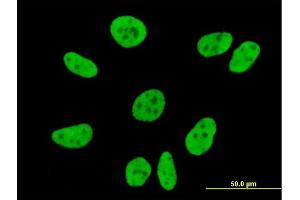 Immunofluorescence of monoclonal antibody to FLJ20097 on HeLa cell. (Syndetin/VPS50 antibody  (AA 862-964))