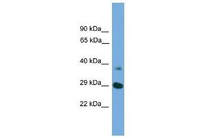 WB Suggested Anti-ATG16L1 Antibody Titration: 0. (ATG16L1 antibody  (Middle Region))