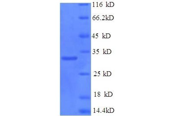 PRKDC Protein (AA 3747-4015) (His tag)