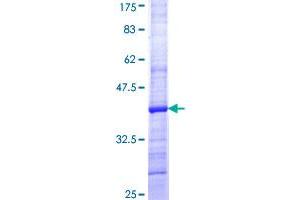 Image no. 1 for Hepatocyte Growth Factor (Hepapoietin A, Scatter Factor) (HGF) (AA 619-728) protein (GST tag) (ABIN1306590) (HGF Protein (AA 619-728) (GST tag))