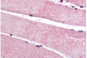 Anti-BEST3 antibody  ABIN1048353 IHC staining of human skeletal muscle. (Bestrophin 3 antibody  (C-Term))