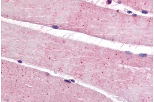 Bestrophin 3 antibody  (C-Term)