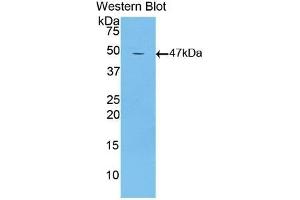 Detection of Recombinant LTbR, Mouse using Polyclonal Antibody to Lymphotoxin Beta Receptor (LTbR) (LTBR antibody  (AA 128-395))