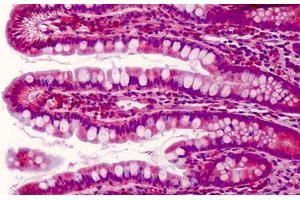 Human Small Intestine: Formalin-Fixed, Paraffin-Embedded (FFPE) (PDCD5 antibody  (C-Term))