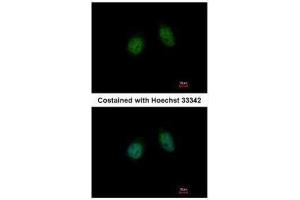 ICC/IF Image Immunofluorescence analysis of paraformaldehyde-fixed HeLa, using Annexin V, antibody at 1:500 dilution. (Annexin V antibody)