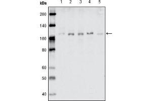 Western blot analysis using EhpB1 mouse mAb against MDA-MB-468 (1), MDA-MB-453 (2), MCF-7 (3), T47D (4) and SKBR-3 (5) cell lysate. (EhpB1 (AA 19-133) antibody)