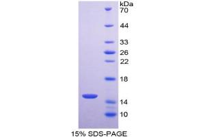 SDS-PAGE analysis of Human Aconitase 1 Protein. (Aconitase 1 Protein (ACO1))