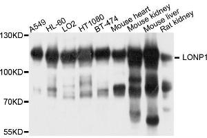 Western blot analysis of extracts of various cell lines, using LONP1 antibody. (LONP1 antibody  (AA 120-400))