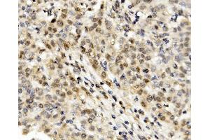 IHC analysis of MNT using anti-MNT antibody (ABIN7601555). (MNT antibody  (AA 381-564))