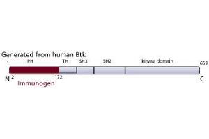 Image no. 2 for anti-Bruton Agammaglobulinemia tyrosine Kinase (BTK) (AA 2-172), (N-Term) antibody (ABIN968375) (BTK antibody  (N-Term))