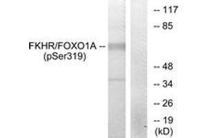 Western blot analysis of extracts from HeLa cells treated with EGF, using FKHR (Phospho-Ser319) Antibody. (FOXO1 antibody  (pSer319))