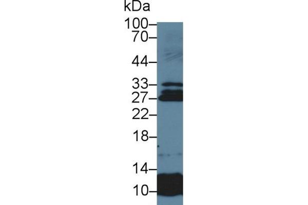 SOSTDC1 抗体  (AA 24-206)