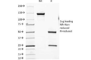 SDS-PAGE Analysis Purified CD6 Mouse Monoclonal Antibody (SPV-L14). (CD6 antibody)