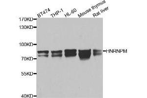Western blot analysis of extracts of various cell lines, using HNRNPM antibody.