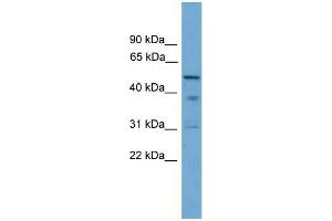 Human PANC1; WB Suggested Anti-TINAG Antibody Titration: 0. (TINAG antibody  (Middle Region))