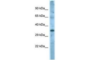 Image no. 1 for anti-Fas Ligand (TNF Superfamily, Member 6) (FASL) (AA 121-170) antibody (ABIN6748197) (FASL antibody  (AA 121-170))