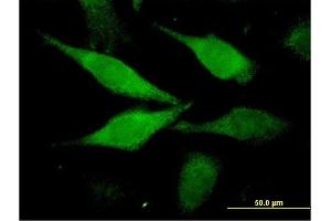 Immunofluorescence of monoclonal antibody to C1orf80 on HeLa cell. (AIDA antibody  (AA 1-306))