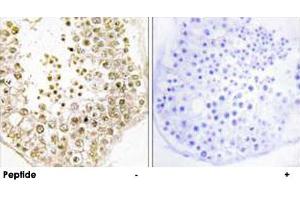 Immunohistochemistry analysis of paraffin-embedded human testis tissue, using SPZ1 polyclonal antibody . (SPZ1 antibody)