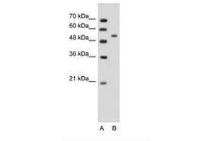Image no. 1 for anti-Perilipin 1 (PLIN1) (AA 81-130) antibody (ABIN203499) (PLIN1 antibody  (AA 81-130))