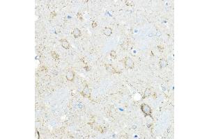 Immunohistochemistry (IHC) image for anti-Leucyl/cystinyl Aminopeptidase (LNPEP) (AA 1-110) antibody (ABIN6143284)