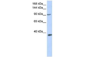 WB Suggested Anti-EPAS1 Antibody Titration:  0. (EPAS1 antibody  (Middle Region))