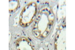 Used in DAB staining on fromalin fixed paraffin-embedded kidney tissue (PLVAP antibody  (AA 123-393))