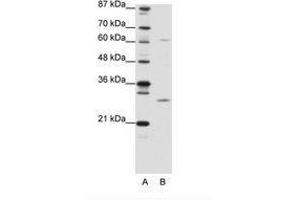 Image no. 1 for anti-Mediator Complex Subunit 7 (MED7) (N-Term) antibody (ABIN6736137) (MED7 antibody  (N-Term))