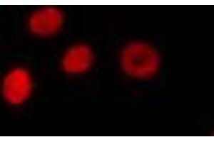 Immunofluorescence (fixed cells) (IF/ICC) image for anti-Cleavage Stimulation Factor, 3' Pre-RNA, Subunit 1, 50kDa (CSTF1) (N-Term) antibody (ABIN6258094)