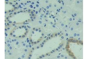 Immunohistochemistry (IHC) image for anti-Calcyphosine (CAPS) (AA 1-189) antibody (ABIN7434845)