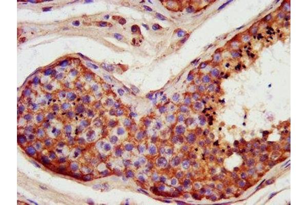 FATE1 antibody  (AA 1-162)