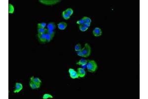 Immunofluorescent analysis of MCF-7 cells using ABIN7160555 at dilution of 1:100 and Alexa Fluor 488-congugated AffiniPure Goat Anti-Rabbit IgG(H+L) (MYL9 antibody  (AA 2-172))