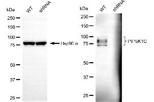 Western blotting analysis using PIP5K1C antibody (ABIN7799794).