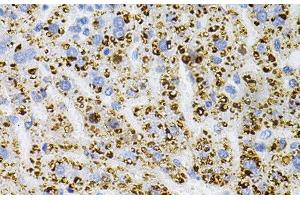 Immunohistochemistry of paraffin-embedded Rat liver using NTRK1 Polyclonal Antibody at dilution of 1:100 (40x lens).