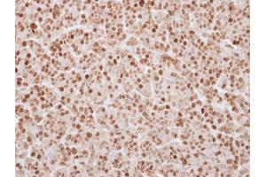 IHC-P Image Immunohistochemical analysis of paraffin-embedded BT483 xenograft, using UHRF1, antibody at 1:250 dilution. (UHRF1 antibody)
