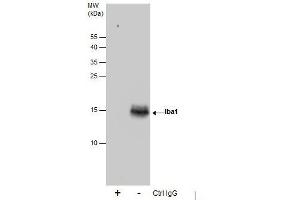 IP Image Immunoprecipitation of Iba1 protein from K562 whole cell extracts using 5 μg of Iba1 antibody, Western blot analysis was performed using Iba1 antibody, EasyBlot anti-Rabbit IgG  was used as a secondary reagent.