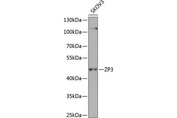 Zona Pellucida Glycoprotein 3 antibody  (AA 170-390)