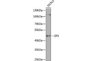 Western blot analysis of extracts of SKOV3 cells, using ZP3 antibody (ABIN6130818, ABIN6150537, ABIN6150539 and ABIN6224382) at 1:1000 dilution. (Zona Pellucida Glycoprotein 3 antibody  (AA 170-390))