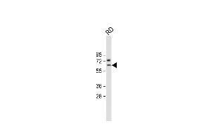 Anti-SMTNL1 Antibody (Center) at 1:2000 dilution + RD whole cell lysate Lysates/proteins at 20 μg per lane. (SMTNL1 antibody  (AA 130-159))