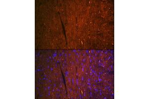 Immunofluorescence analysis of mouse heart using F Rabbit mAb (ABIN7267152) at dilution of 1:100 (40x lens). (FABP3 antibody)