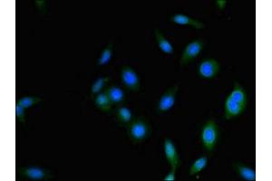 Immunofluorescence staining of Hela cells with ABIN7142208 at 1:333, counter-stained with DAPI. (PSMD2 antibody  (Regulatory Subunit 2))