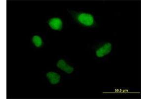 Immunofluorescence of purified MaxPab antibody to PSMB5 on HeLa cell. (PSMB5 antibody  (AA 1-263))