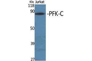Western Blot (WB) analysis of specific cells using PFK-C Polyclonal Antibody. (PFKP antibody  (Internal Region))
