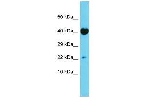 Host: Rabbit Target Name: TRAPPC6A Sample Type: HT1080 Whole Cell lysates Antibody Dilution: 1.