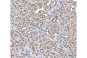 IHC analysis of AREB6/ZEB1 using anti-AREB6/ZEB1 antibody (ABIN7602990).