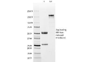 SDS-PAGE Analysis Purified CD2 Mouse Monoclonal Antibody (BH1). (CD2 antibody)