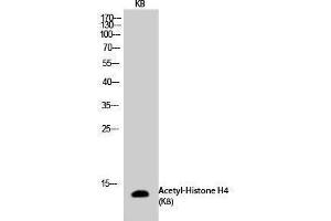 Western Blotting (WB) image for anti-Histone H4 (acLys8) antibody (ABIN3179372) (Histone H4 antibody  (acLys8))