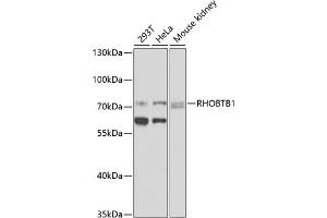 Western blot analysis of extracts of various cell lines, using RHOBTB1 antibody (ABIN6128679, ABIN6146936, ABIN6146937 and ABIN6225297) at 1:1000 dilution. (RHOBTB1 antibody  (AA 240-400))