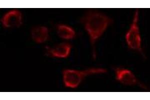 ABIN6269323 staining HeLa cells by IF/ICC. (LIPE antibody  (Internal Region))