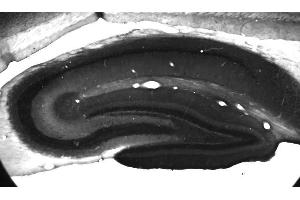 Adult rat hippocampus immunohistochemistry.